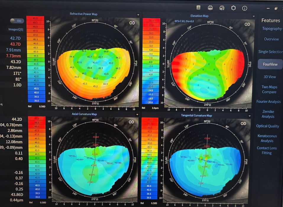 Кератотопограф. Топограф