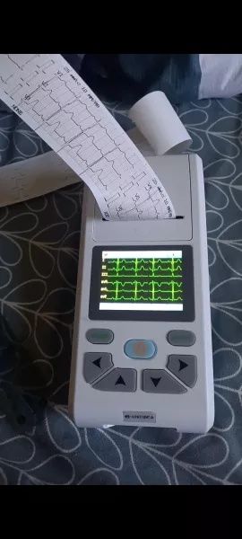 ЕКГ Апарат 12 канала Contec E90A с софтуер за компютър