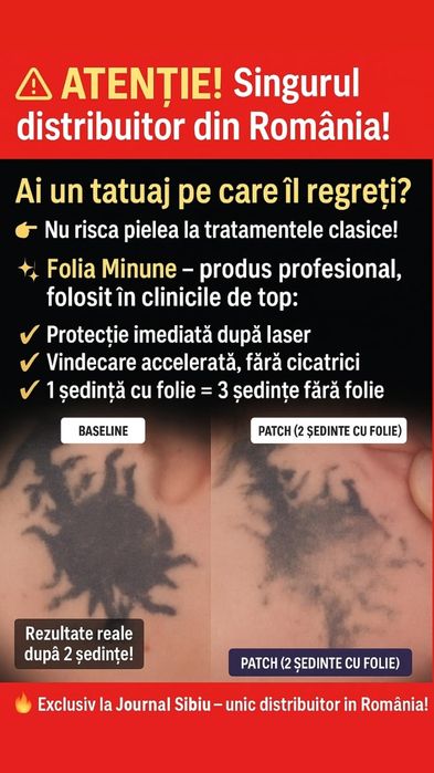 60 lei /500lei 10buc. Folia Magică pentru indepartat tatuaje cu laser