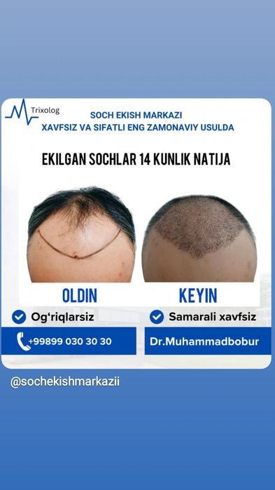 Soch ekish eng zamonaviy usul