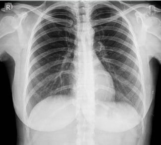 Цифровой рентген аппарат арендага берилади.