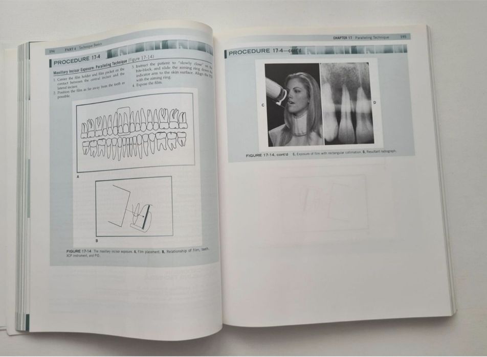 Dental Radiography - Iannucci