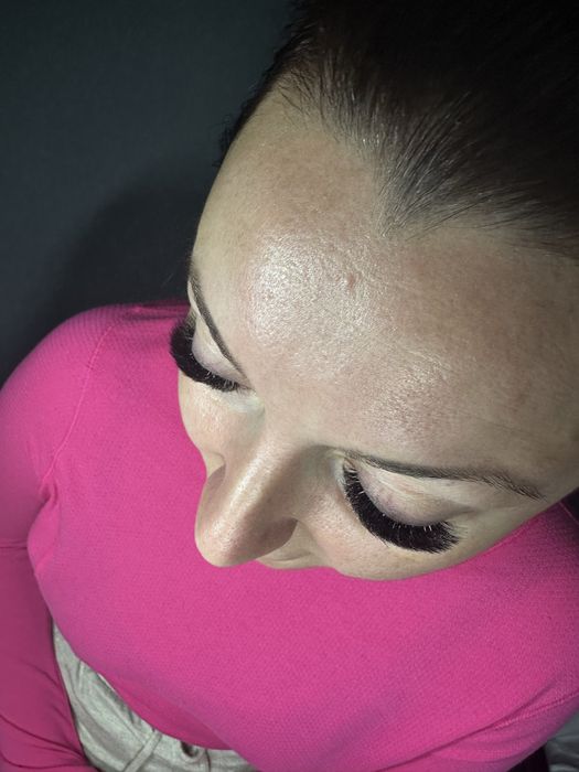 Extensii de gene- Satu Mare