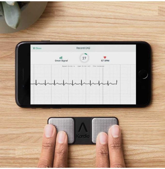KardiaMobile ЕКГ монитор с 1 отвеждане открива AFib нередовни аритмии