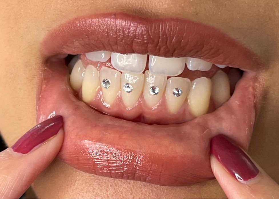 Бижута за Усмивка: DIY Комплект за Декорация на Зъби | Tooth Gem Kit