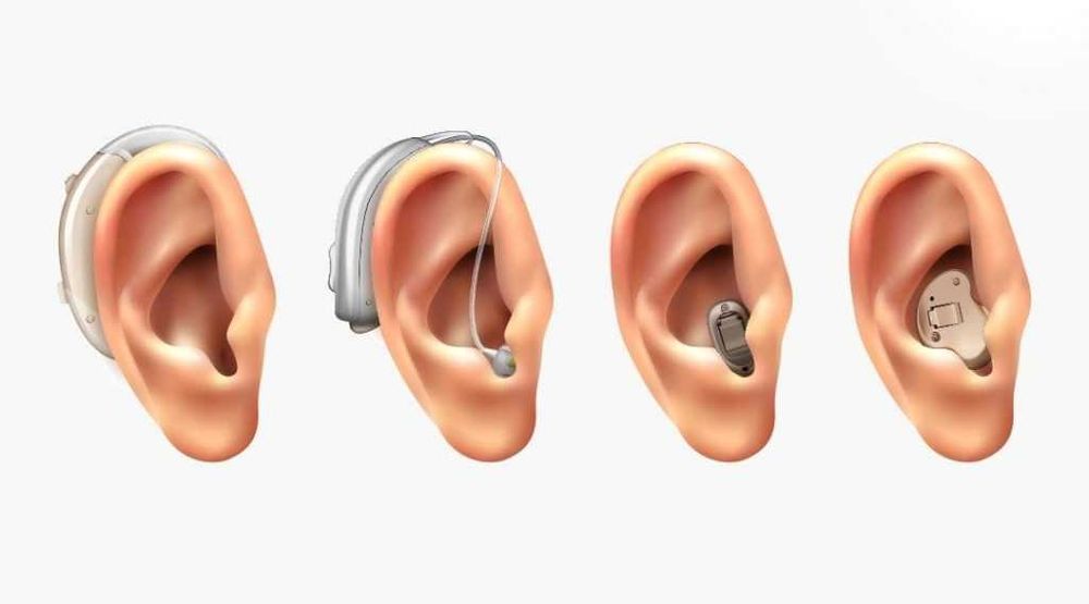 Cлуховой аппарат