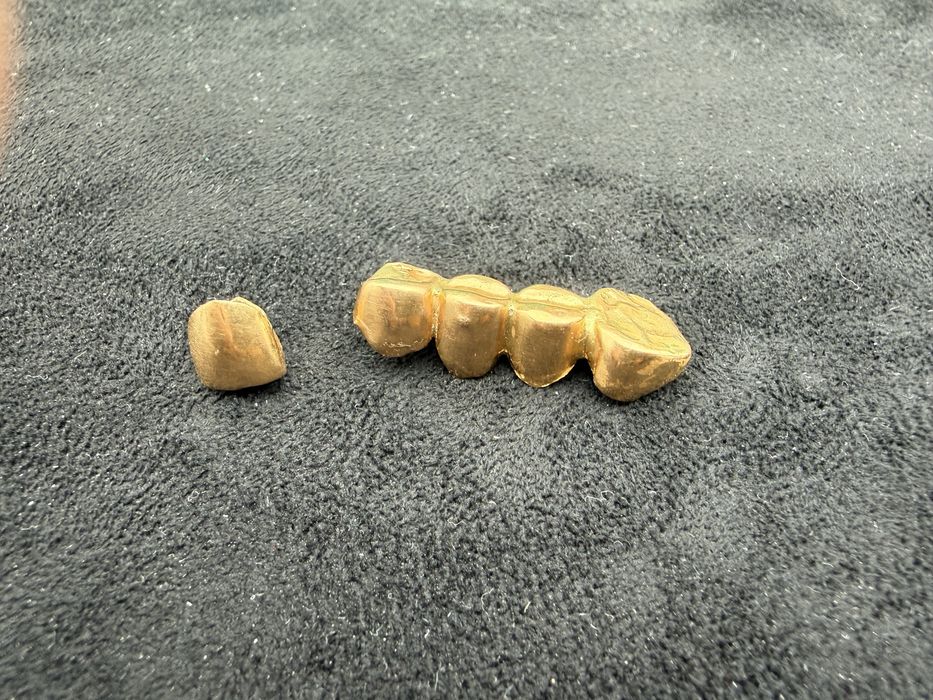 Золтые коронки 4.7 грамм 887 проба