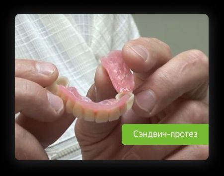 Гибкий протез без нёба