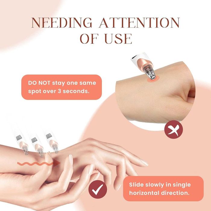 Вакуум за премахване на черни точки