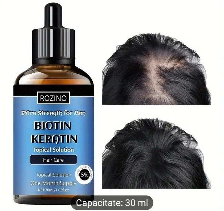 Soluție impotrica căderii parului (eficienta 100%)cu biotina si kerati