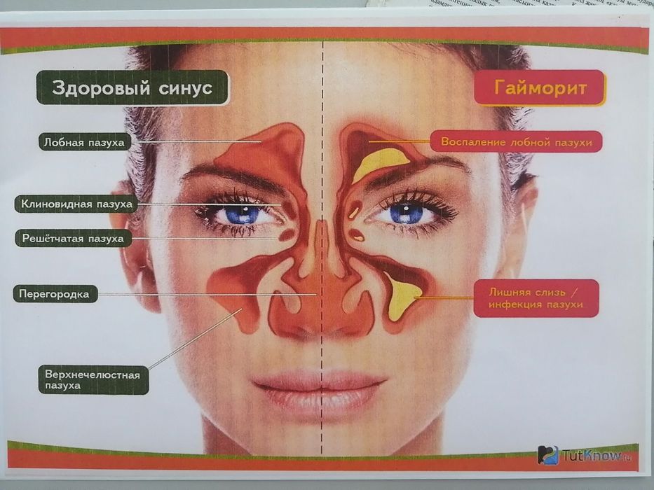 Ипар продукция оригинал