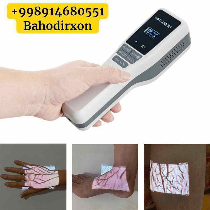 Веновизор оргинал оптом нархда