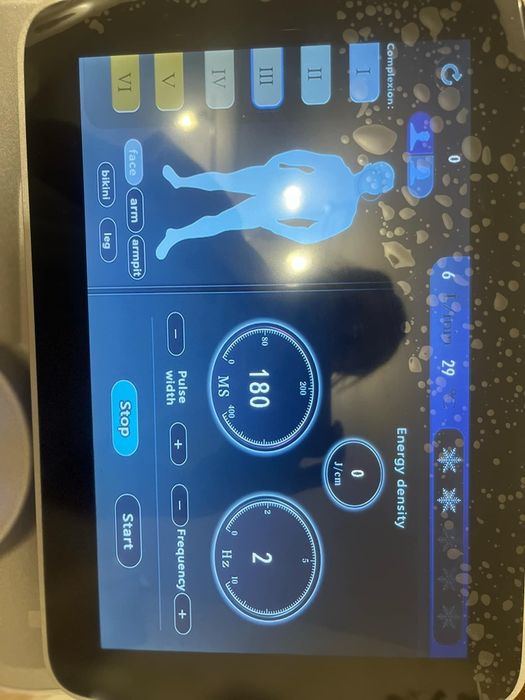 Диоден лазер за обезкосмяване