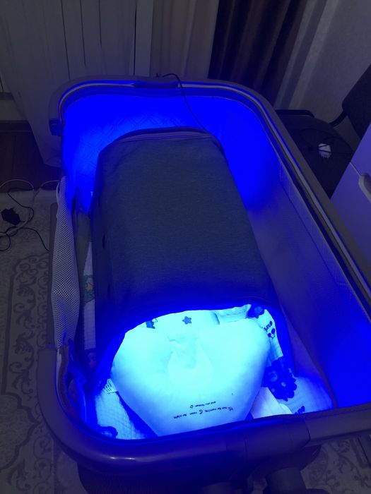 Фотолампа от желтухи