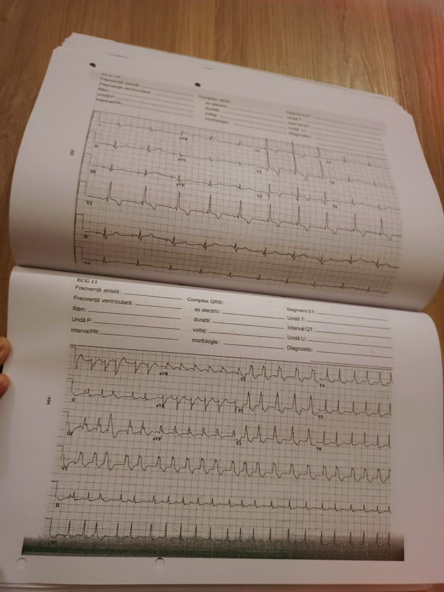 Carte EKG in 10 zile