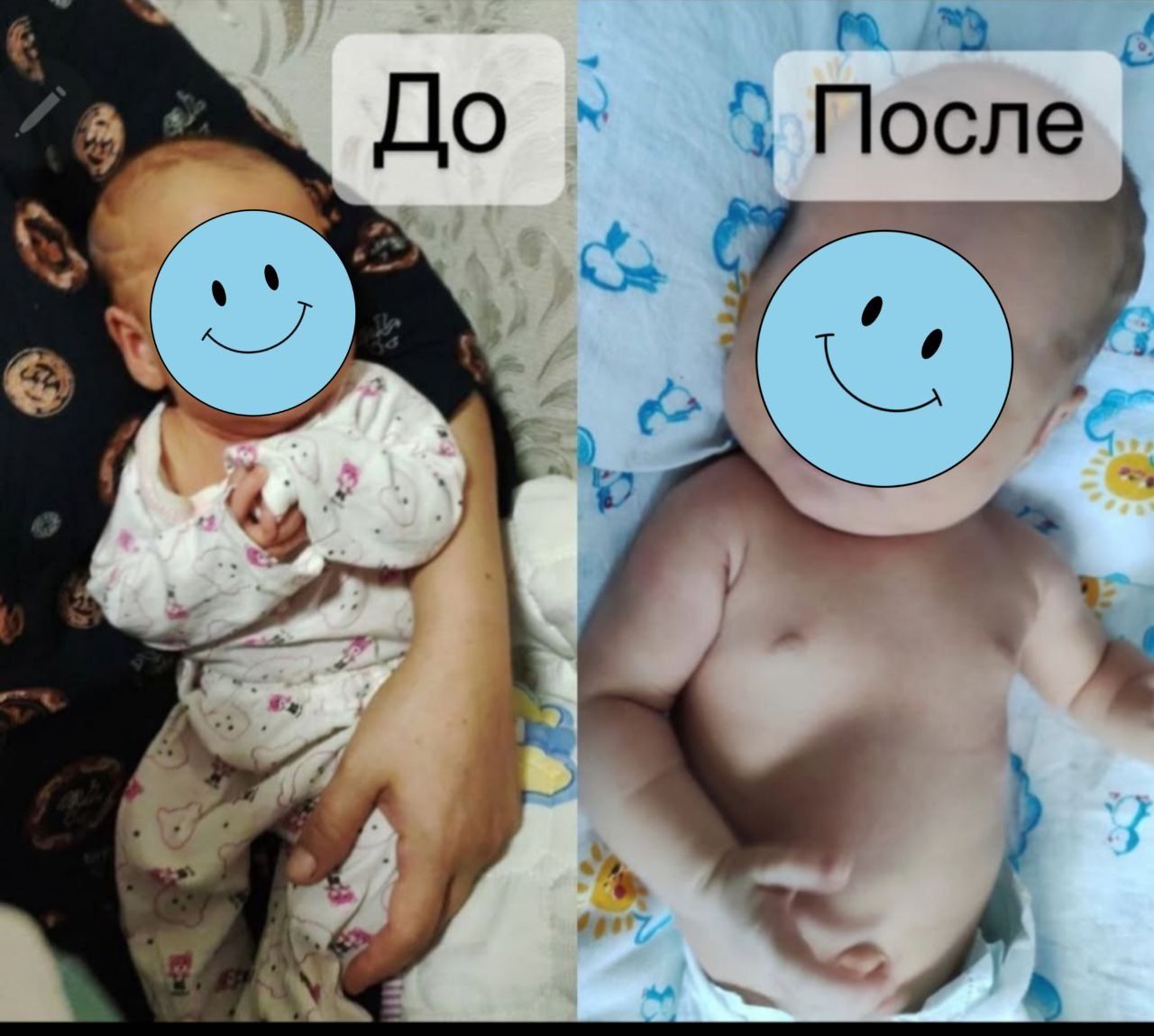 Фотолампа.Фототерапия.Fotolampa.Fototerapiya.100 000 so'm.