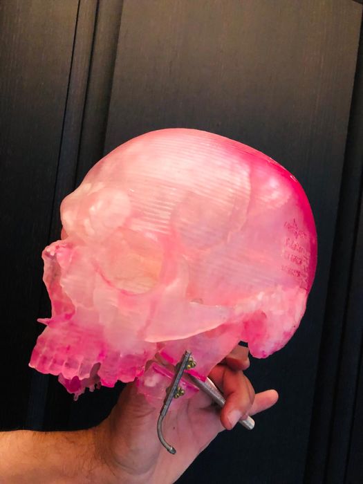 Super aet medical 3D organe craniu in cutii acryl plexiglasss