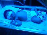 Аренда фотолампы от желтушки для новорождённых детей.  Билитест