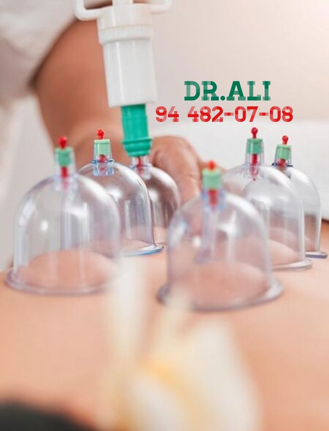 Zuluk va hijama xizmati