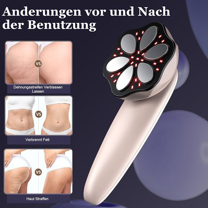 Антицелулитен масажор Robofun 6 в 1 За стягане и изглаждане на кожата