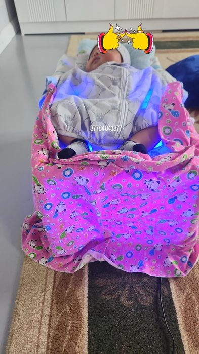 Фотолампа от желтушки билитест замер билурбин