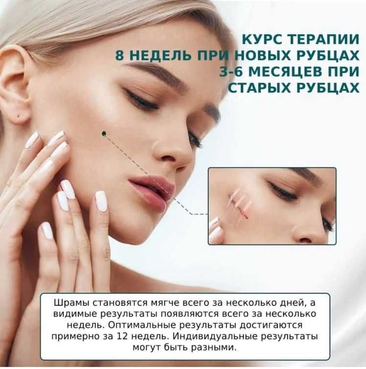 Лучший пластырь от шрамов, рубцов. Прост в применении