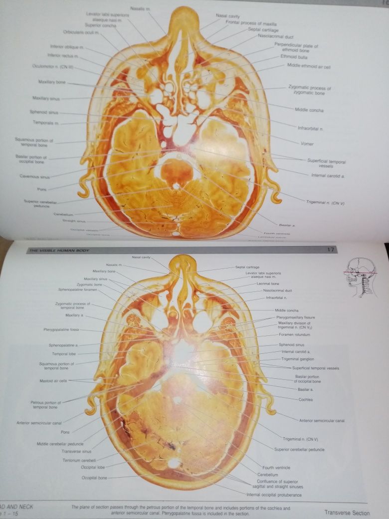 Atlas anatomic uman