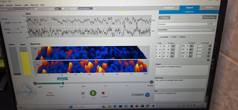 Aparatura Neurofeedback  ILF