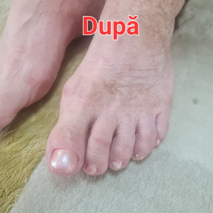 Manichiura și pedichiura profesională podologica la domiciliu