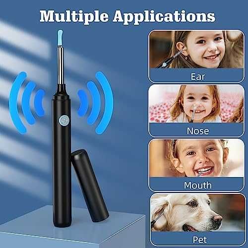 Нов VITCOCO Отоскоп 1080P FHD WiFi - Премахване на Ушна Кал с 6 LED