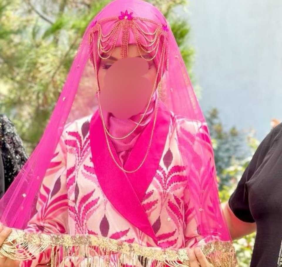 Diadema, Tillaqosh ,zanjir sotiladi
