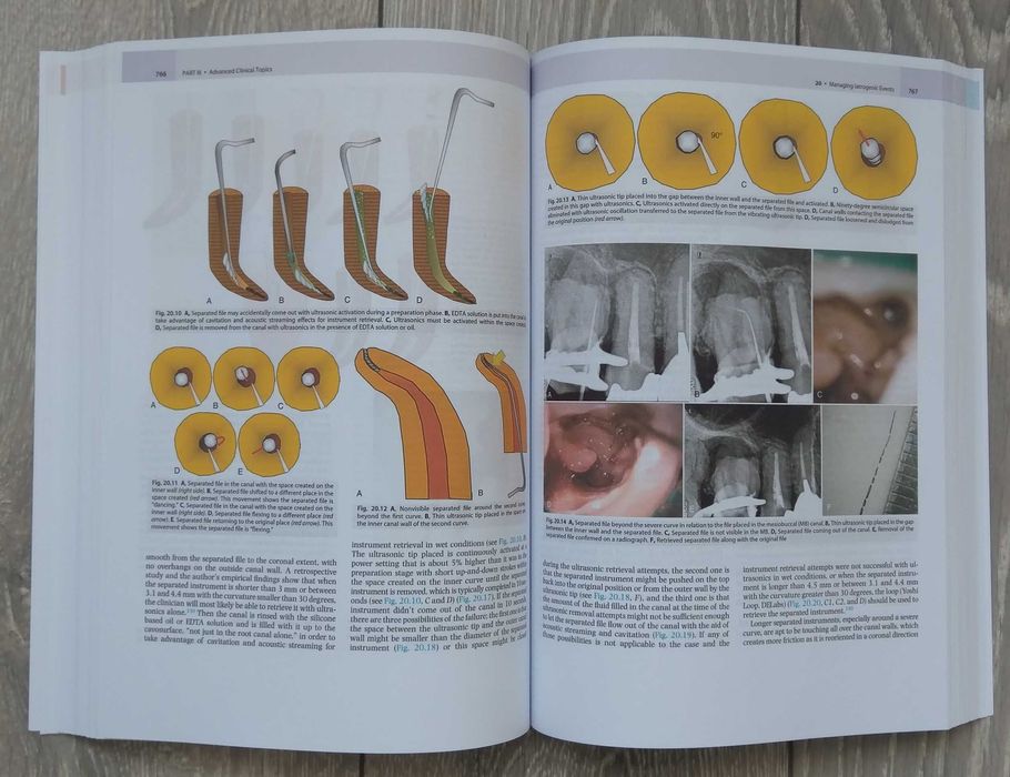Cohen's Pathways of the Pulp: 12th Edition Engleza