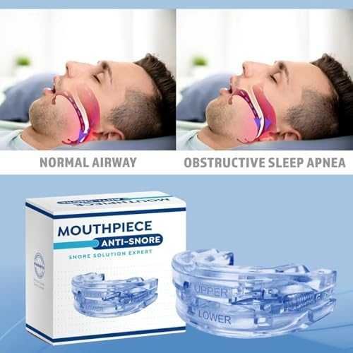 Ново Антихъркащо Устройство 2XL – Комфортна и Ефективна шина за уста