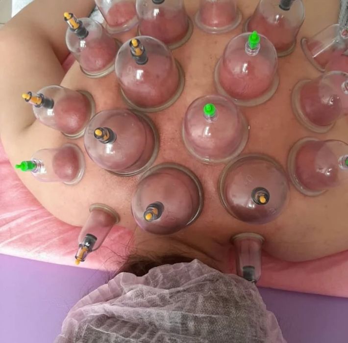 Ставлю банки и делаю массаж спины