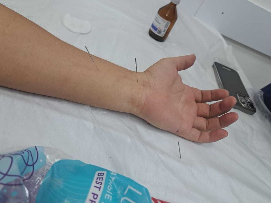 Массаж, иглотерапия,магнитотерапия