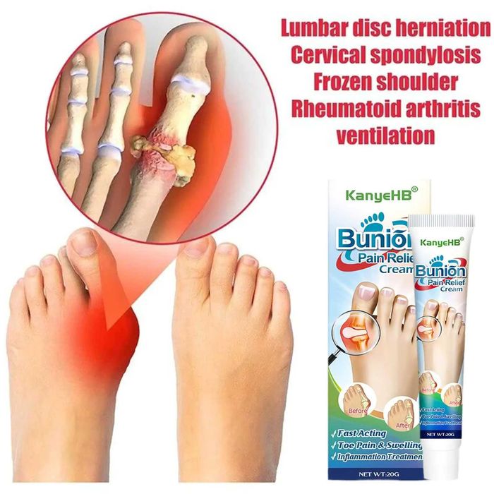 2 buc. Cremă inflamatii articulatii degete, monturi, guta, reparatorie