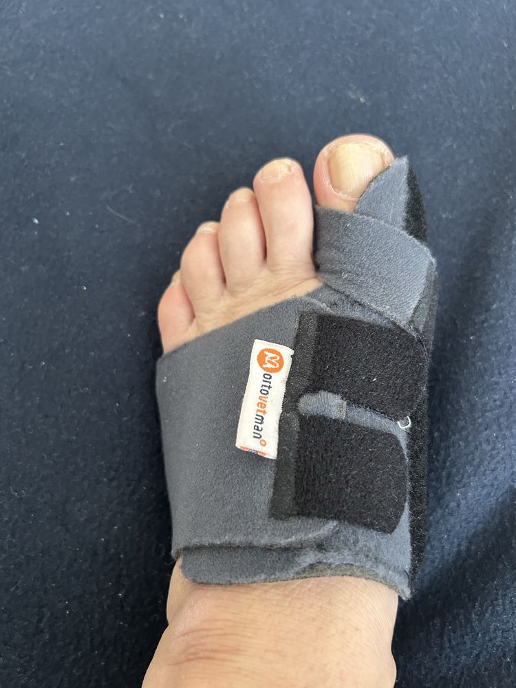 Нощна шина за Hallux Valgus