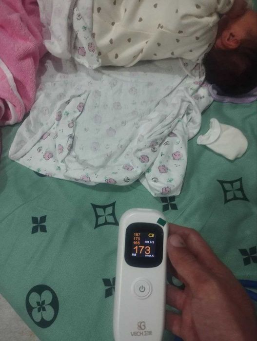 Билрубин олчаб бериш. Служба измерения билирубина