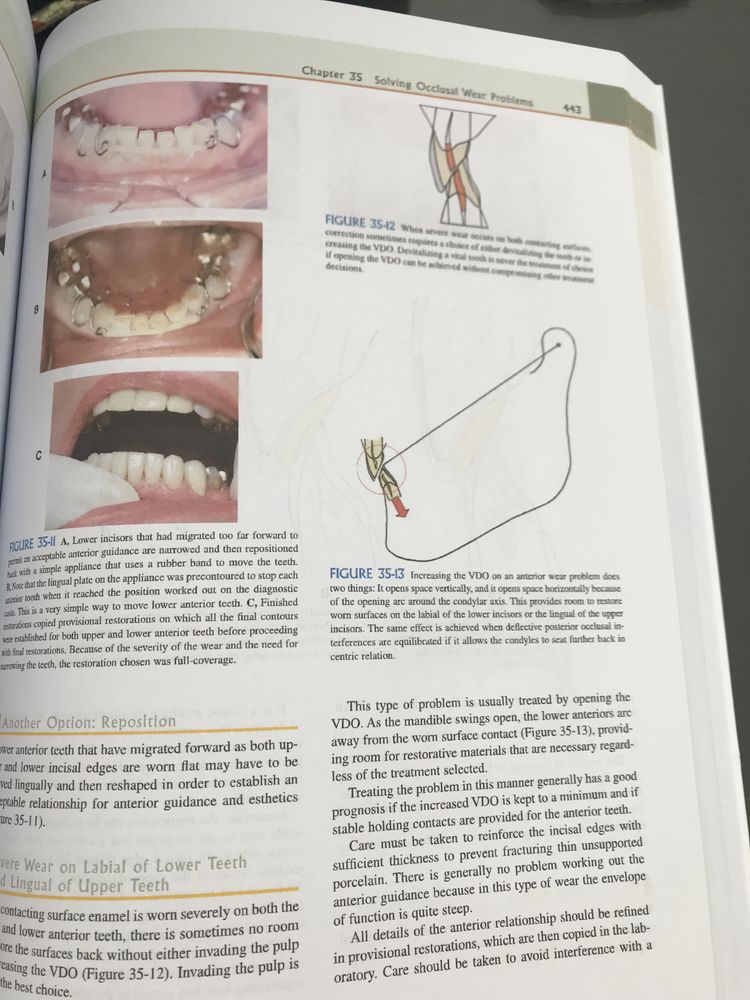 Functional Occlusion from TMJ to Smile Design-Peter E. Dawson