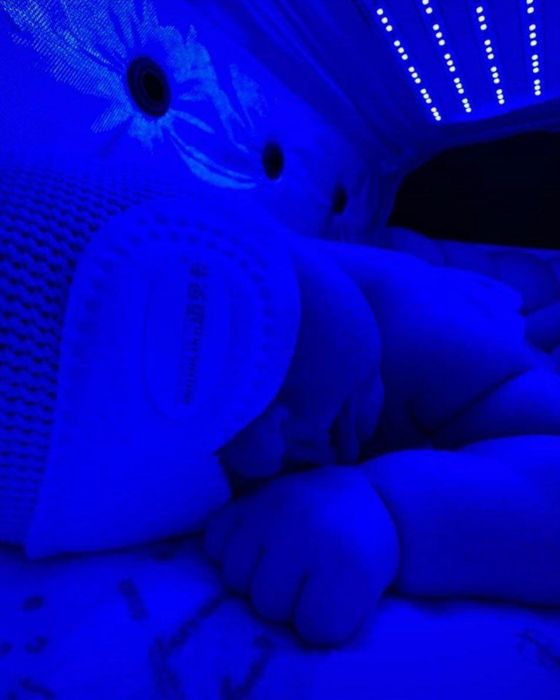 Фотолампа. Фототерапия.Fotolampa. 100 000 СУМ