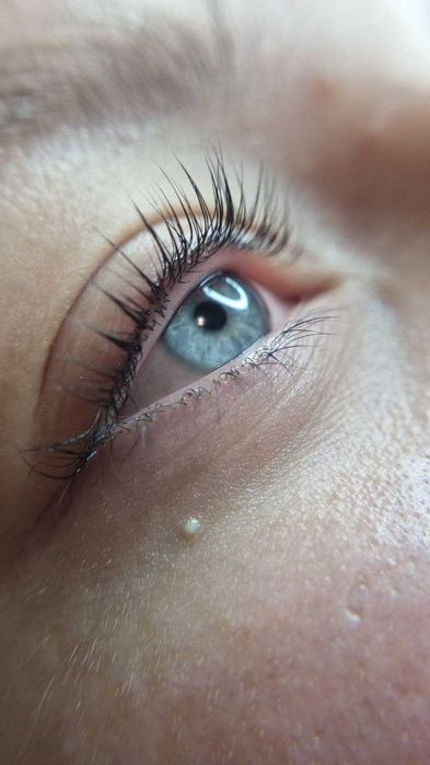 Laminare gene zona Crangasi