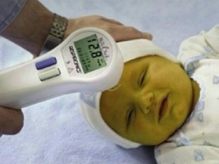 Фотолампа от желтушки Билитест Узынагаш