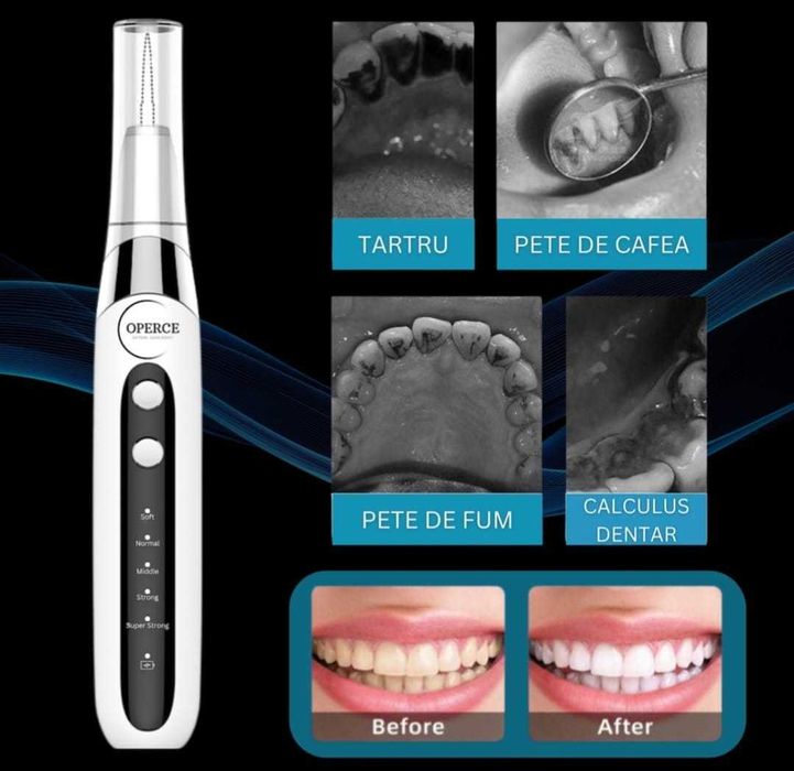 Aparat Detartraj – Nou, 5 Intensități, Rezistent la Apă, 8 Capete