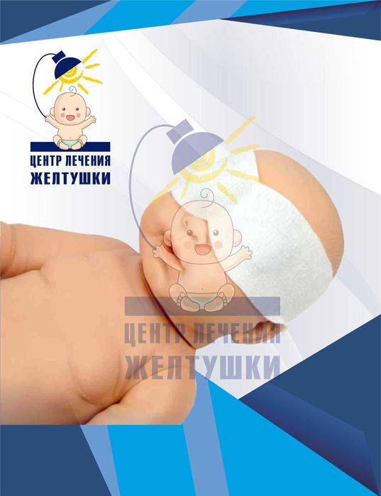 Прокат ламп от желтушки фотолампа