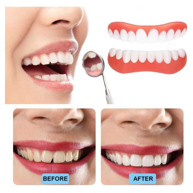 Fațete Dentare Cosmetice SnapSmile – Zâmbet Alb Instant, Reutilizabile