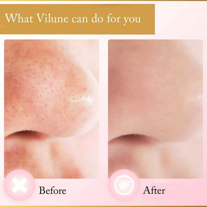 Dispozitiv de îndepărtare a punctelor negre