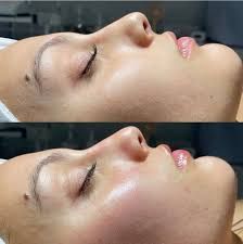 Tratament intens anti-îmbătrânire NuSkin Facial Peel and Neutralizer