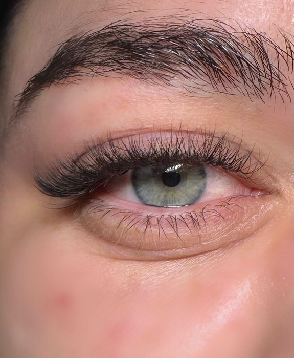 Aplic Extensii De Gene