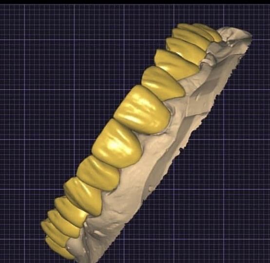 Colaborare Tehnician Dentar