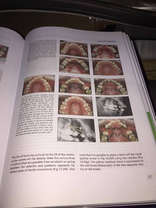The Biomechanical Foundation of Clinical Orthodontics 2015